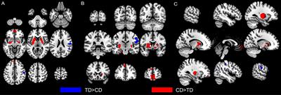 Gray Matter Changes in the Orbitofrontal-Paralimbic Cortex in Male Youths With Non-comorbid Conduct Disorder